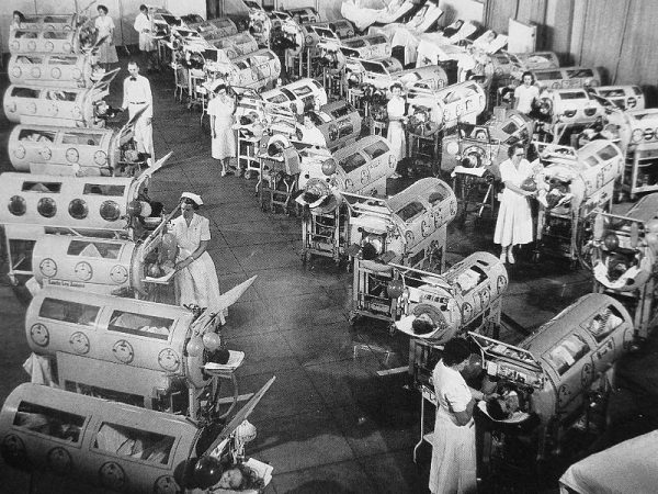 Bildene fra USA på 50-tallet viser store hangarer fylt av polioskadde barn i «jernlunger», den tids pustemaskiner.